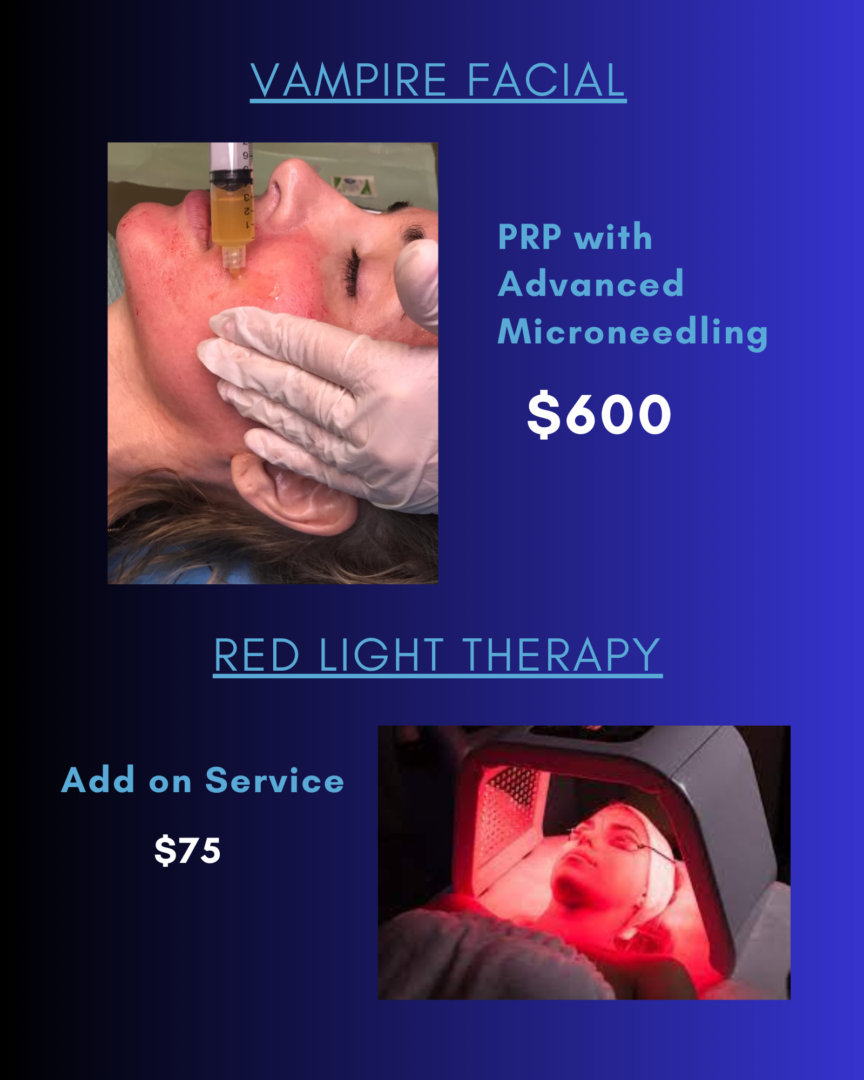 Vampire Facial & Red Light Therapy